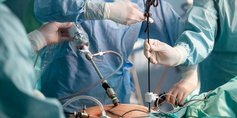 Endokrine Chirurgie