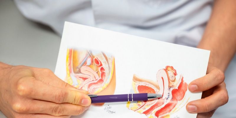 Arzt zeigt mit Kuli auf eine Grafik einer Gebärmutter